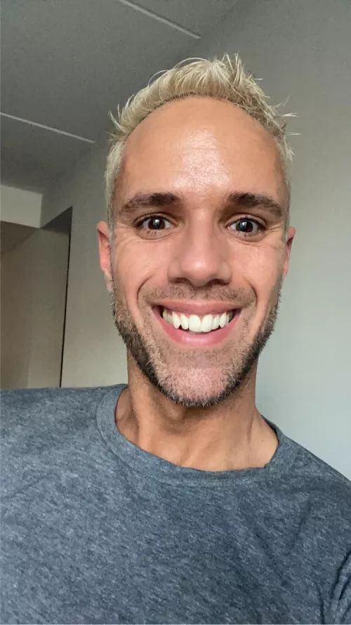 In my mind, I don’t smile. I just flash my canines by Ill-Pin-4283