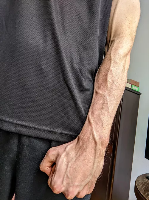 Freckles and veins by bookehuck