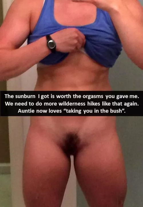 Sunburn on the Snapchat by JQuest7575