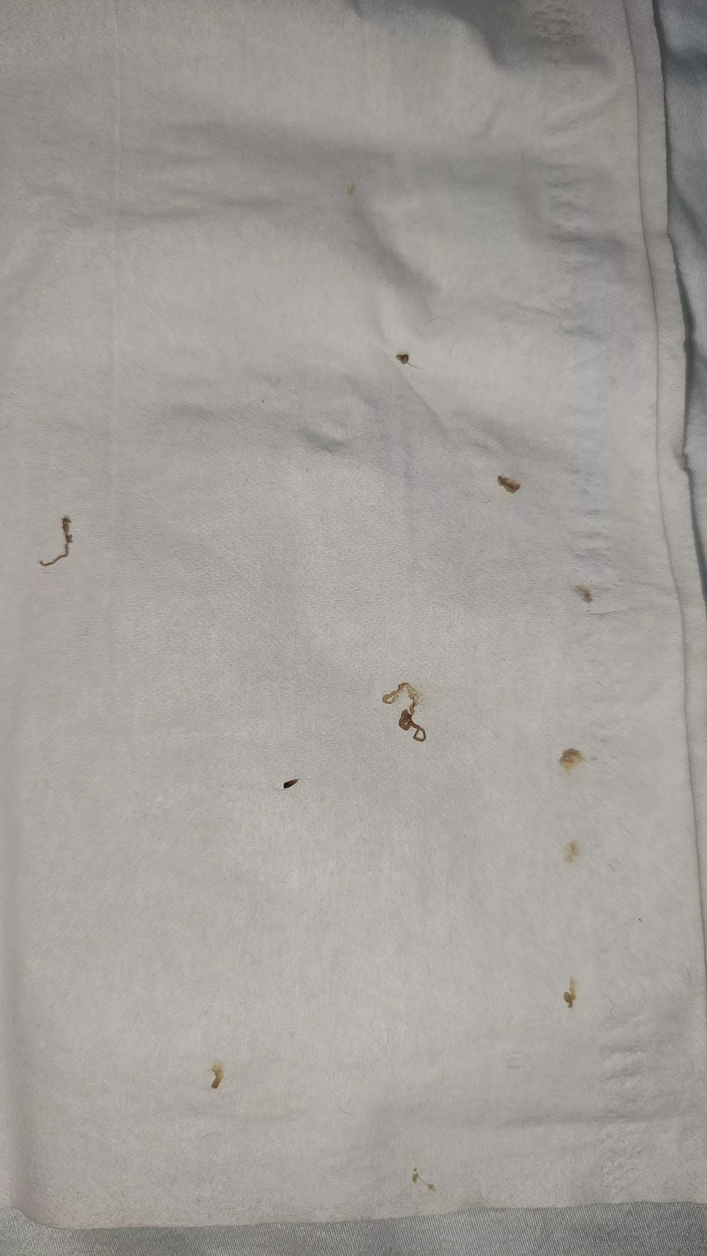 Wife attacked my back tonight. Blackhead/Cyst posted by The4aK3AzN