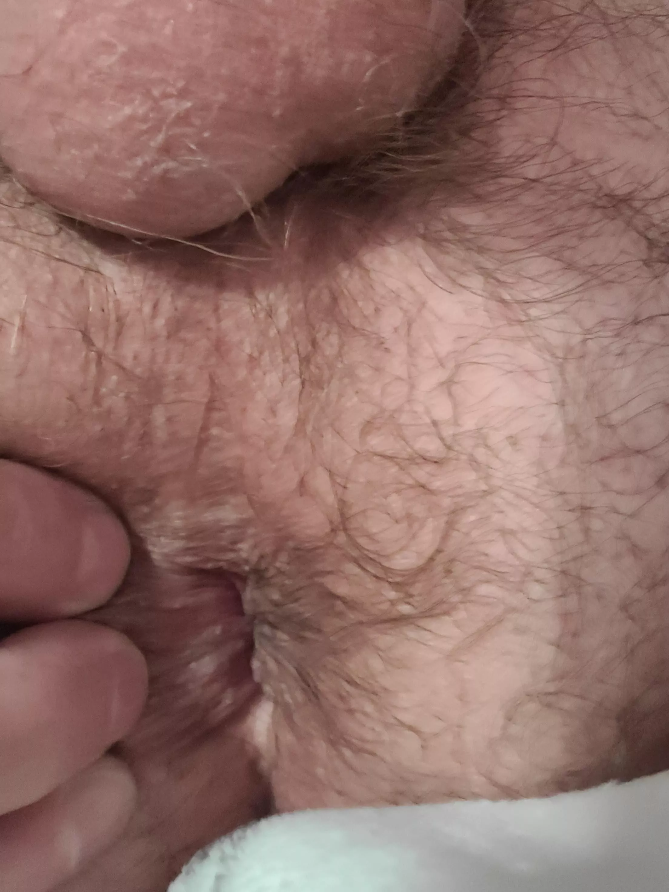 My ass posted by poppajcg