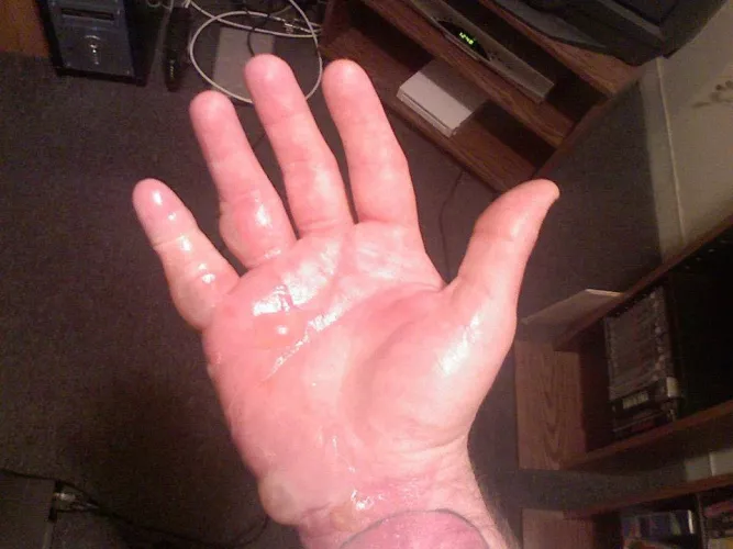 OC, but old (2006ish). Was looking for another picture, when I found this. Don’t drink and pan-fry frozen egg rolls! by coloredverbs