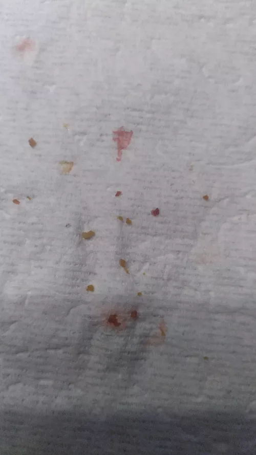 Felt something in my mouth, went digging around and 