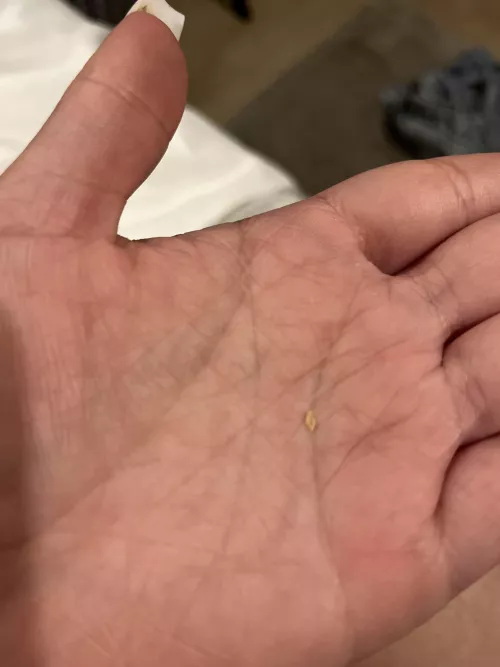 had the urge of scratching my scalp. This came out by nicksbrunchattiffany