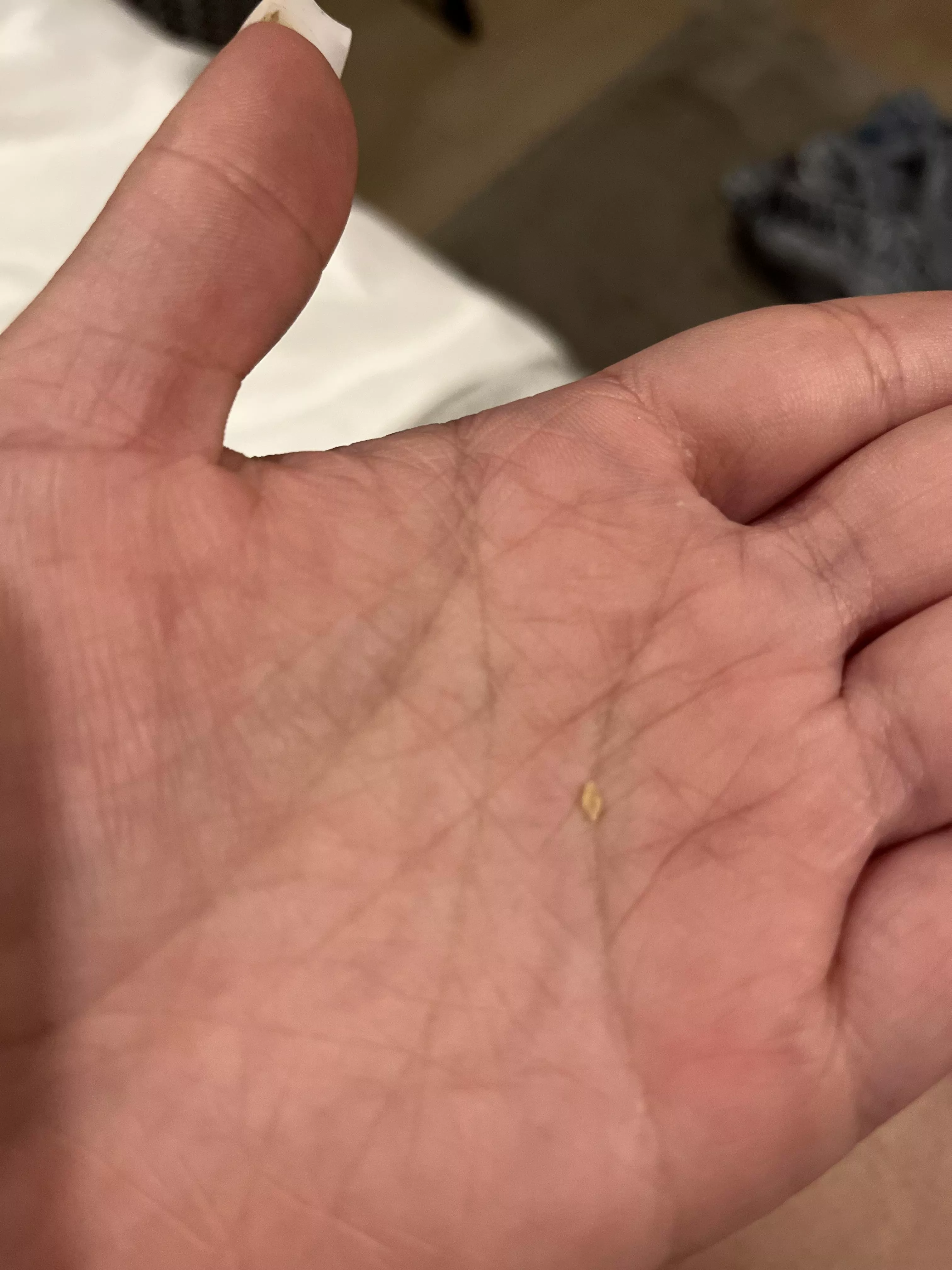 had the urge of scratching my scalp. This came out posted by nicksbrunchattiffany