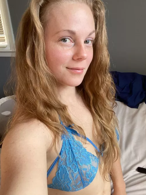 How delicious are my freckles by Amputeelove