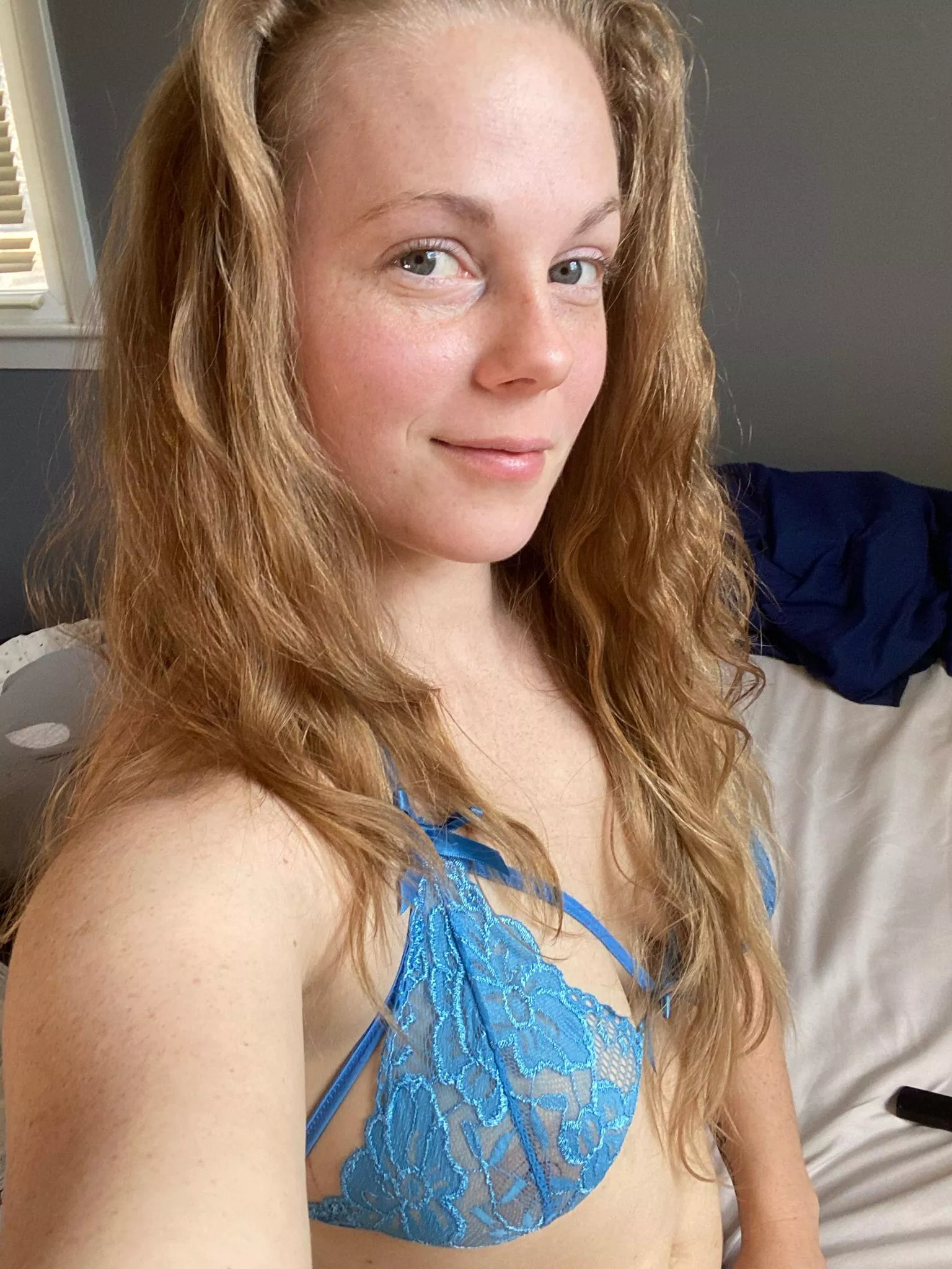 How delicious are my freckles posted by Amputeelove