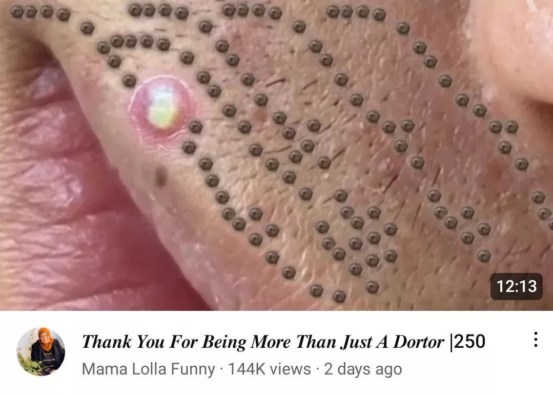 I love when pimples line up so perfectly like this! (Looks totally legit) posted by nortonfries