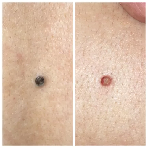 Stupid Pore of Winer—! by VaginalThornbill