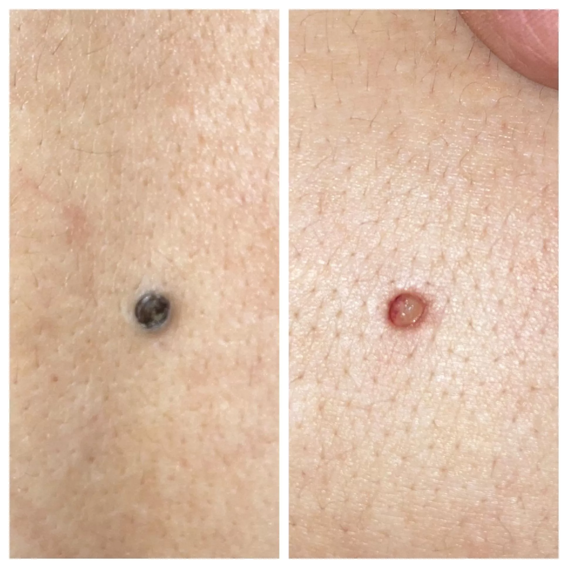 Stupid Pore of Winer—! posted by VaginalThornbill