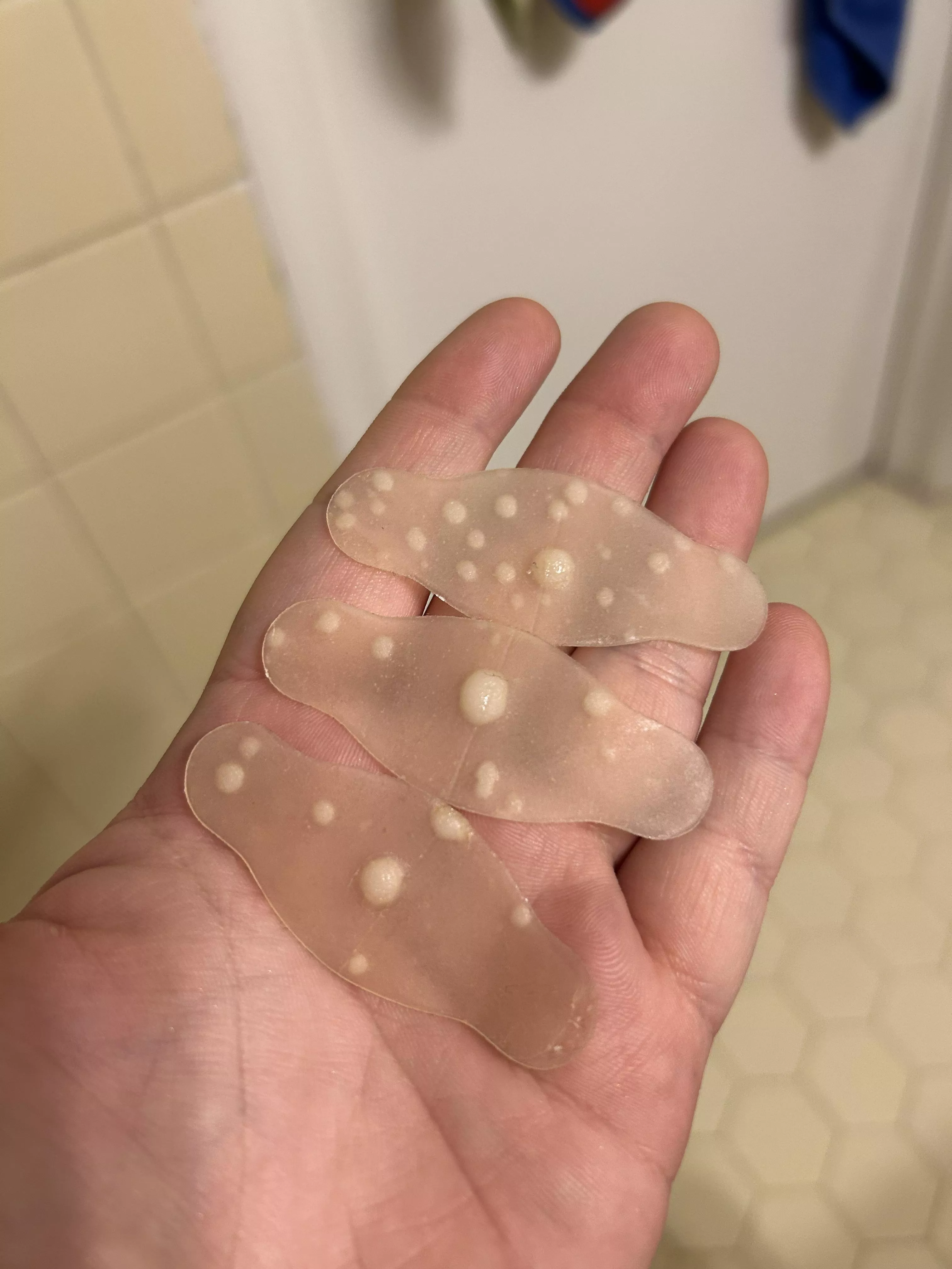 Used some Hydrocolloid patches on my HS flare up - great success! posted by Helpful_Comedian5913