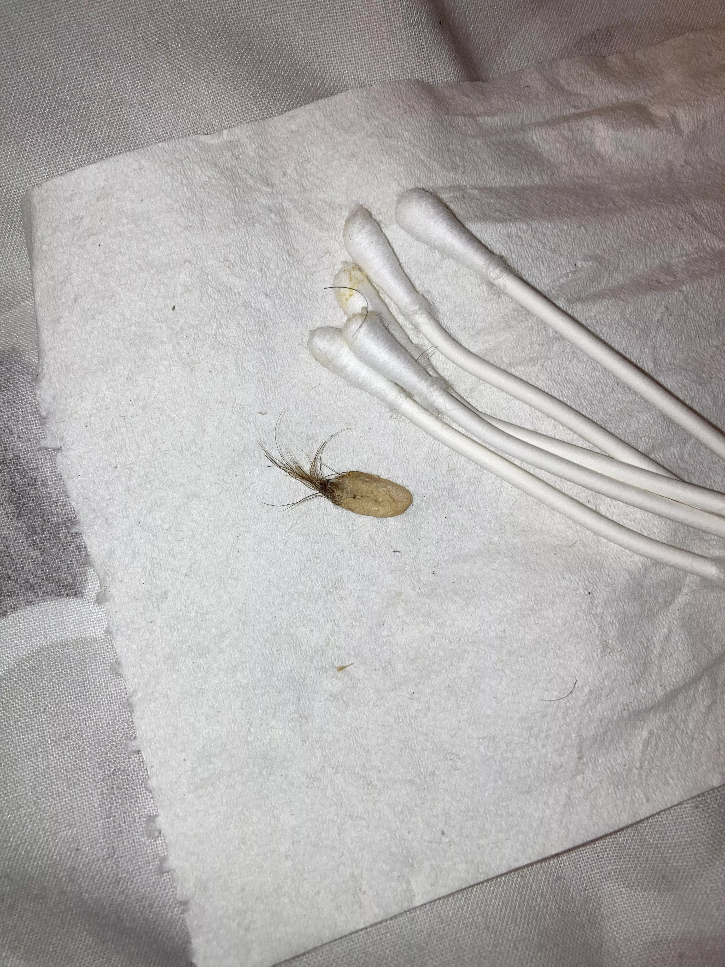 Yanked this from my belly button posted by Ghaidheal