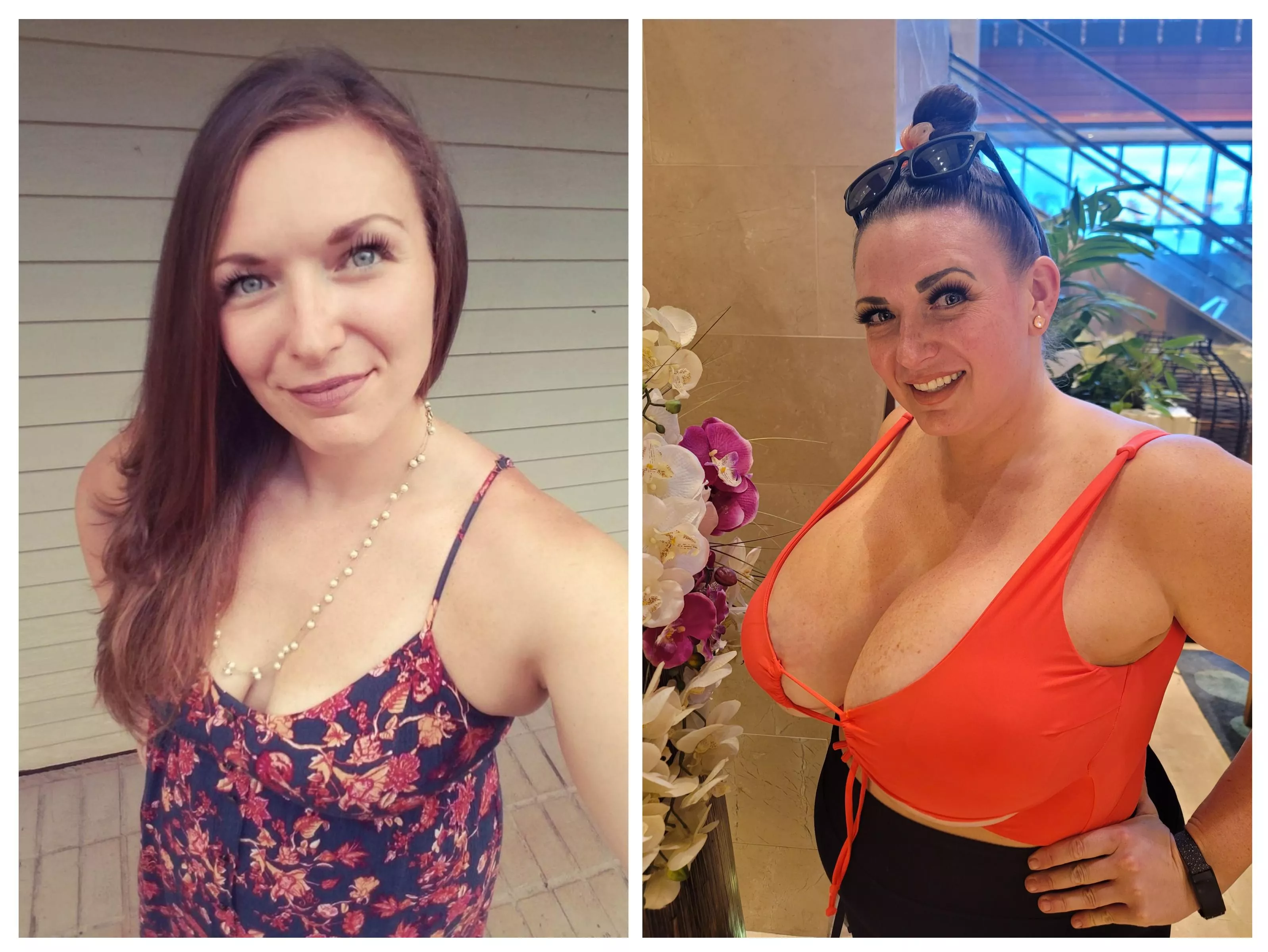 Ex husband told me I was too flat... look what I did with his divorce money. posted by avalonxoxo_2k