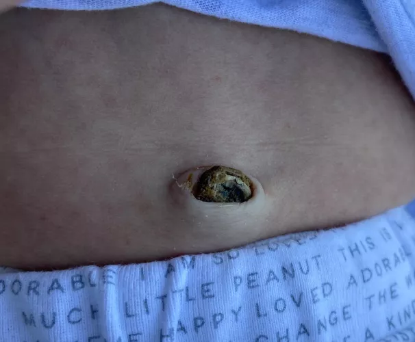 Forbidden Pop: umbilical cord by sweat_shorts