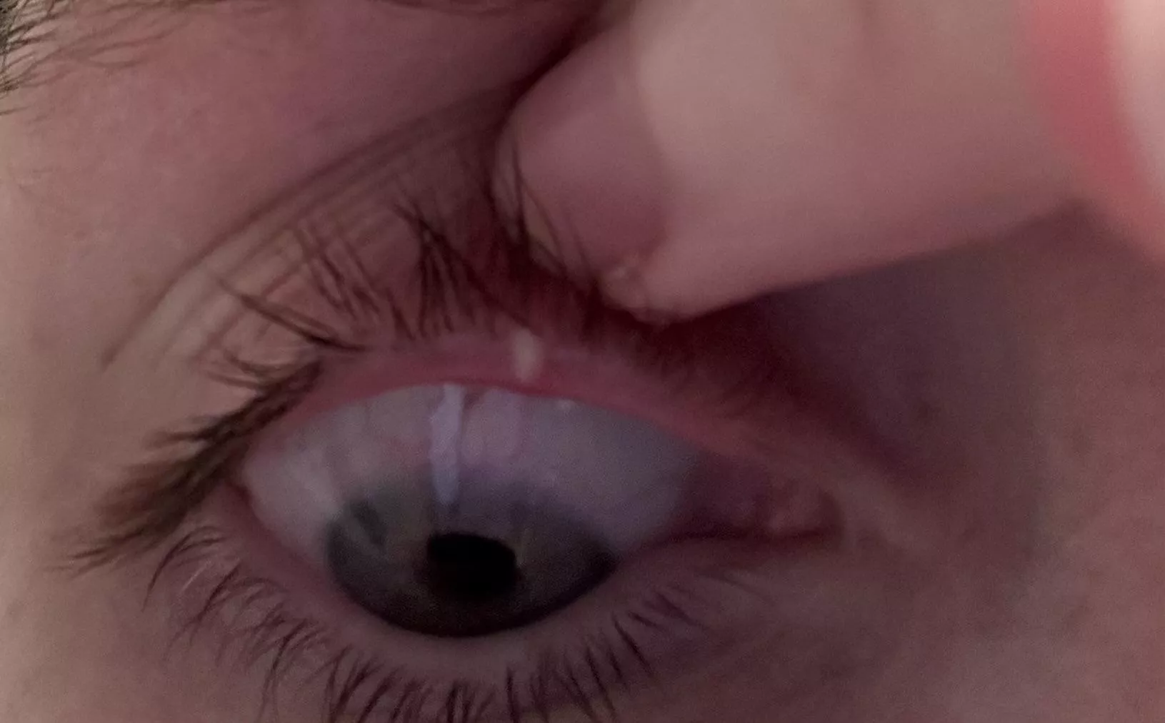 Stye. Started last night. Was able to get it so drain with a warm compress this morning. posted by AlderTree18