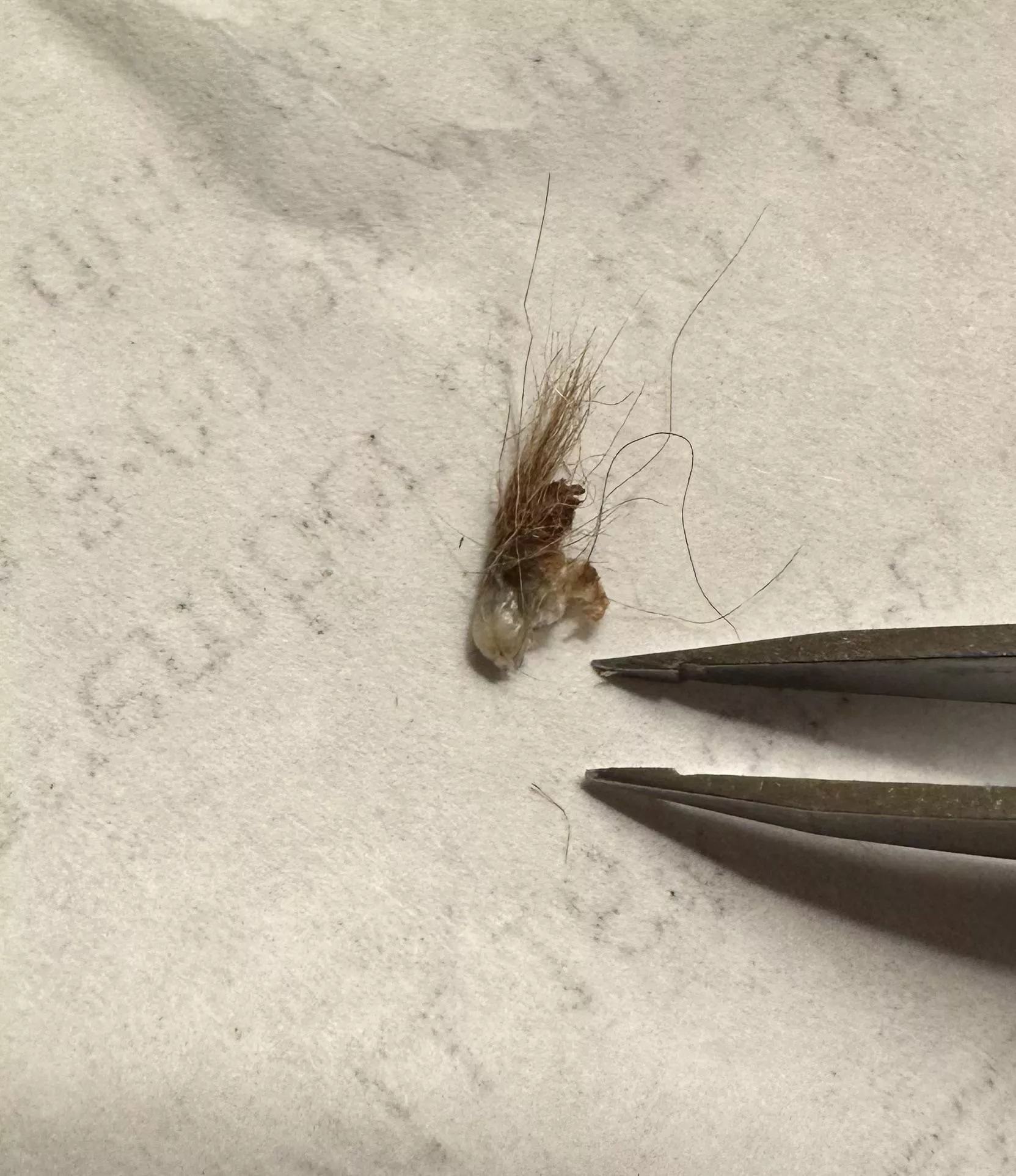 Went mining in husband’s belly button. posted by FridaKohlliner