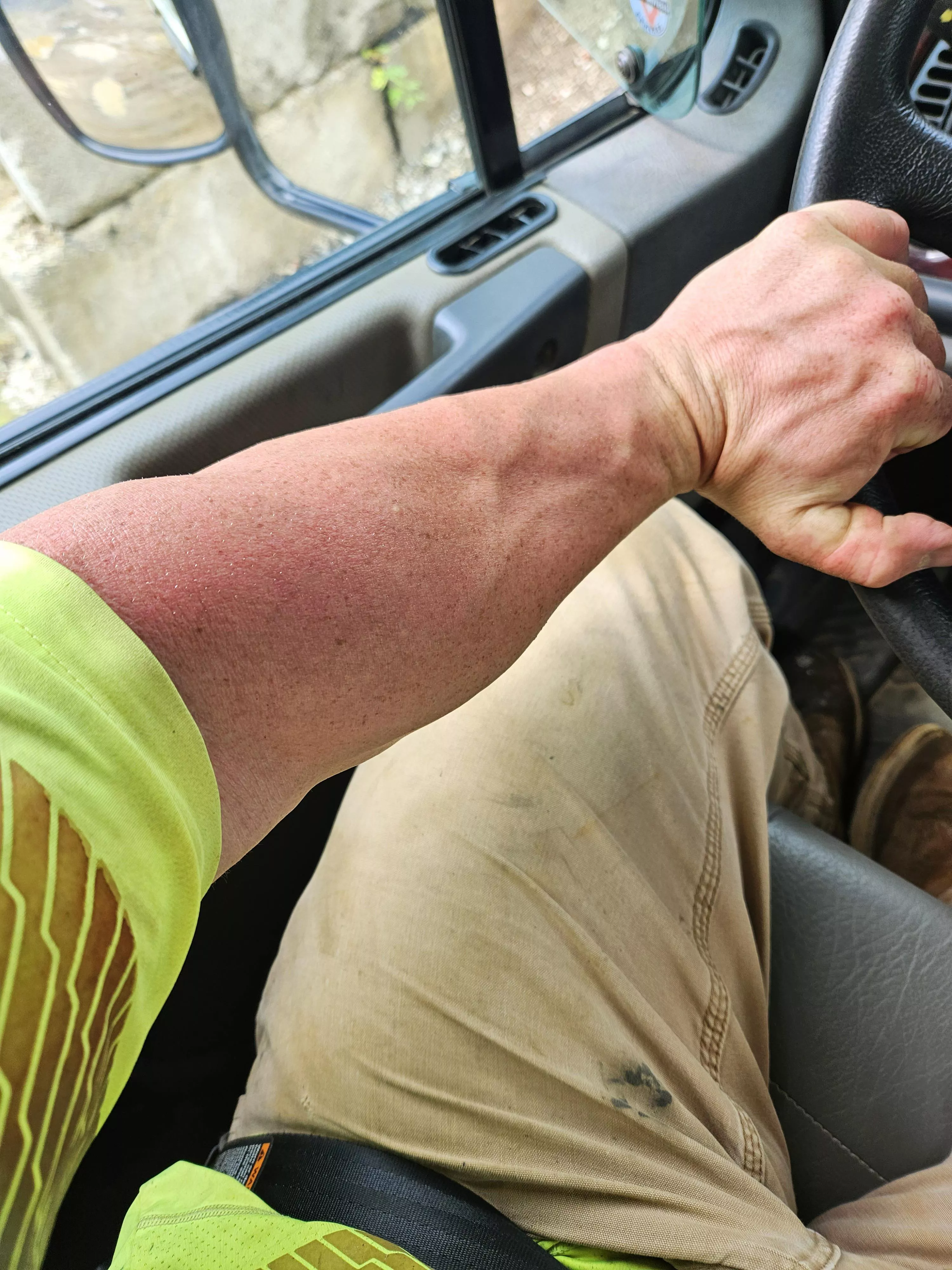 Construction forearms.. posted by Kc1421