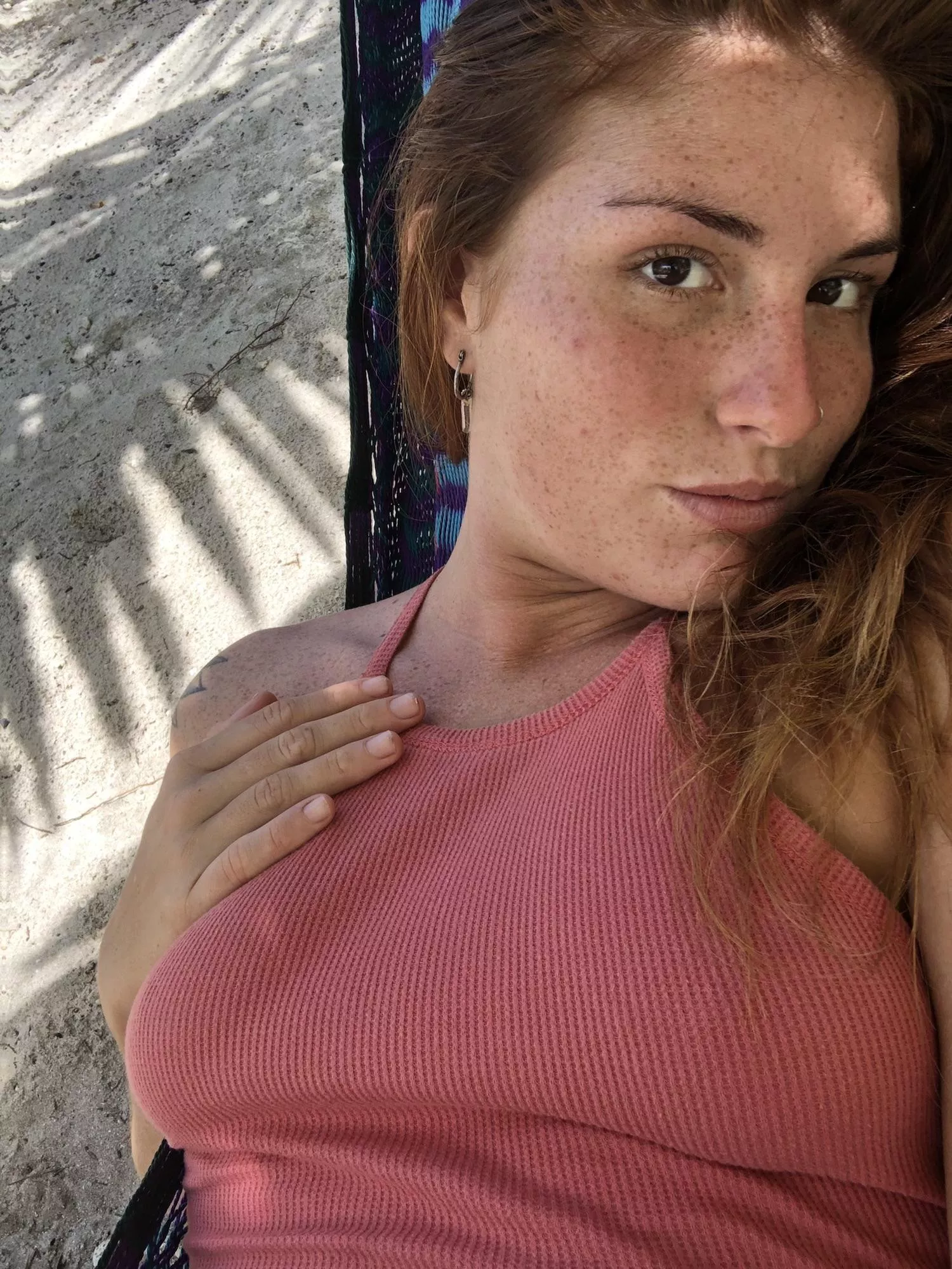 Do I have too many freckles on my face? posted by sugaRedhead