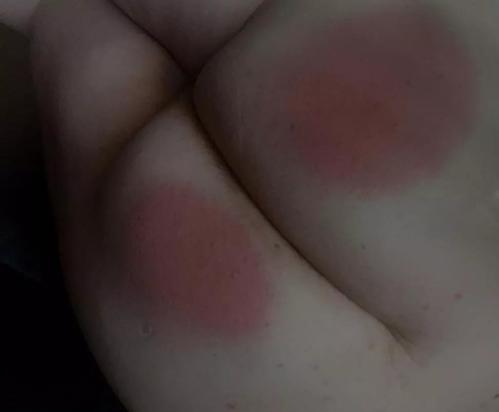 Is my ass red enough? posted by Slutty_turtle04