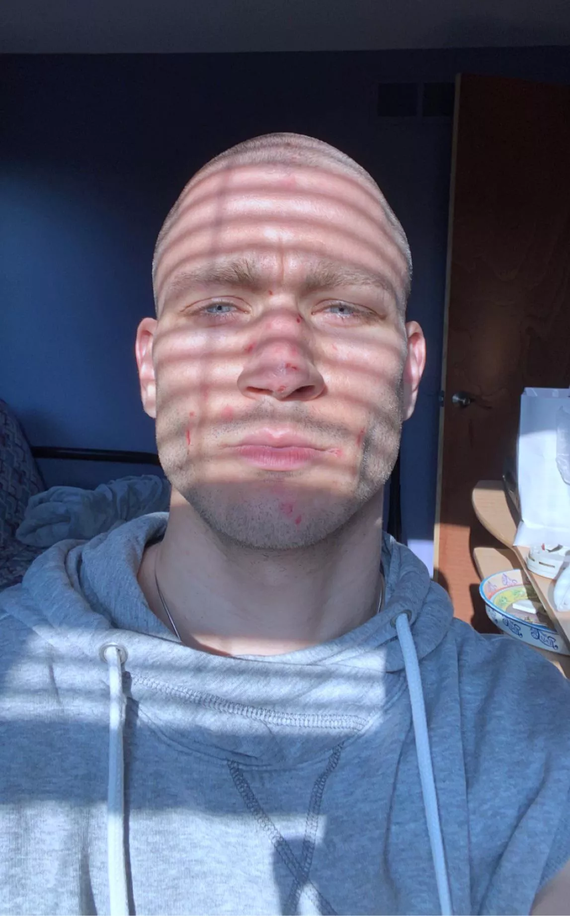 Trigger warning. Blue eyed stare posted by druachu