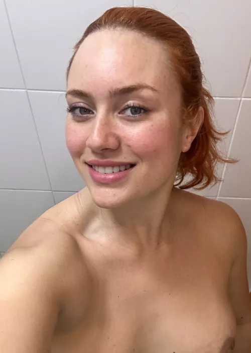 My freckles are all over my body by Puzzled_MJ