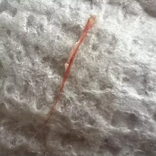 You wanted more pictures. Here is an album of the alleged worms that came out of my outer ear canal by roastbread