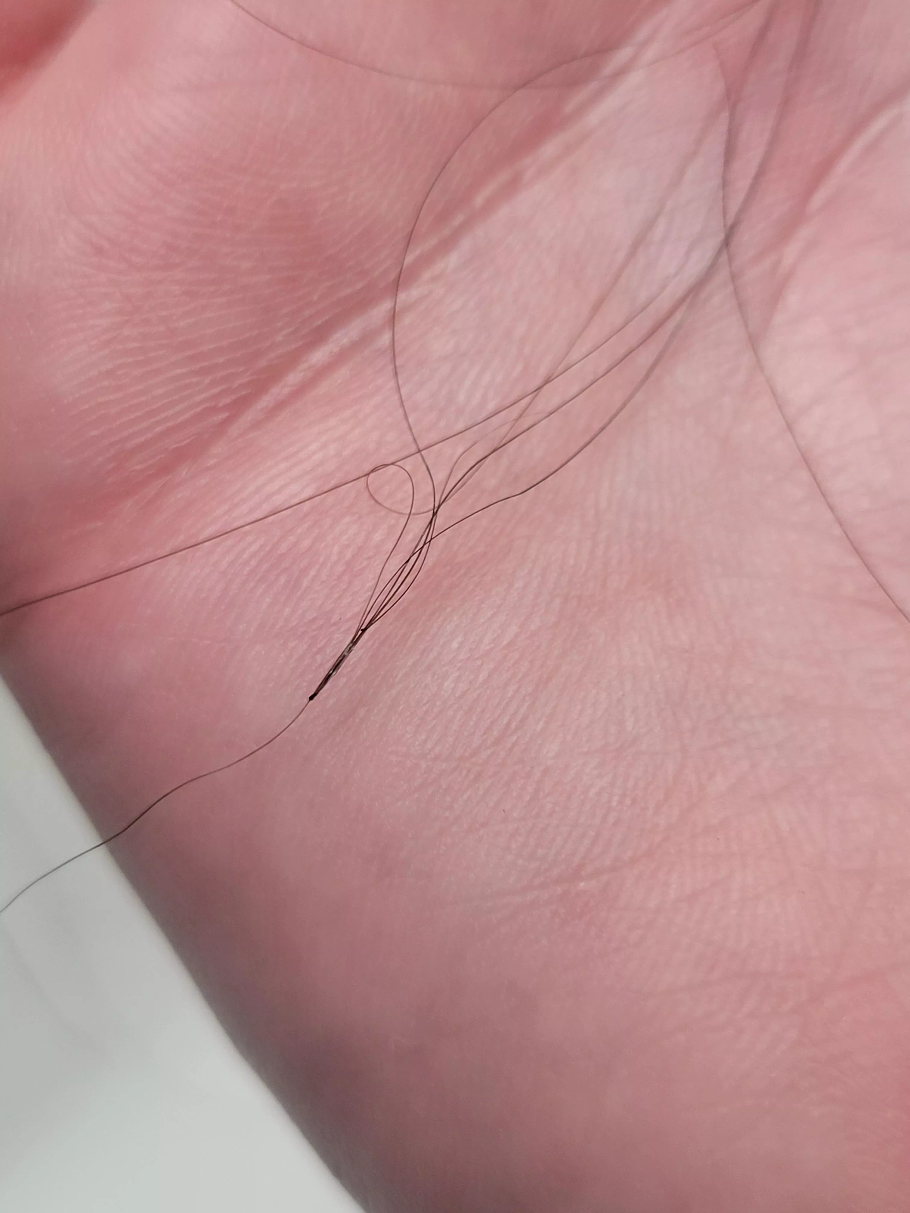 I think this is folliculitis posted by Helpful-Sky4443