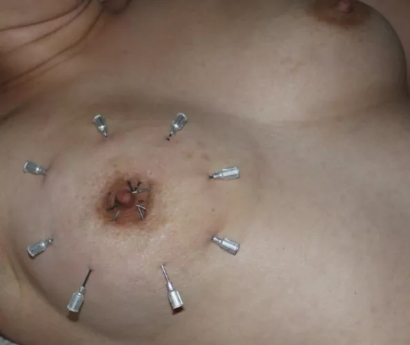 Needles by Intelligent-Bus-4529