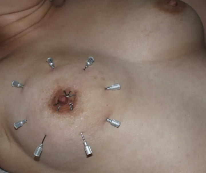 Needles posted by Intelligent-Bus-4529