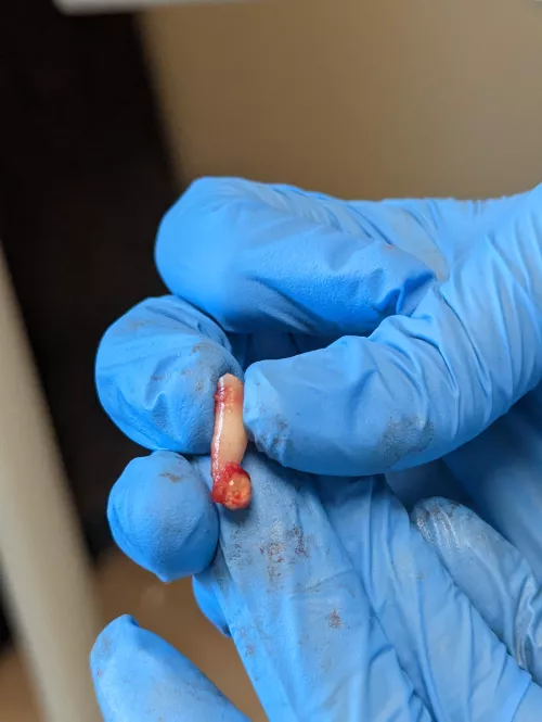 Since we are posting teeth y'all might like this. by masterroon