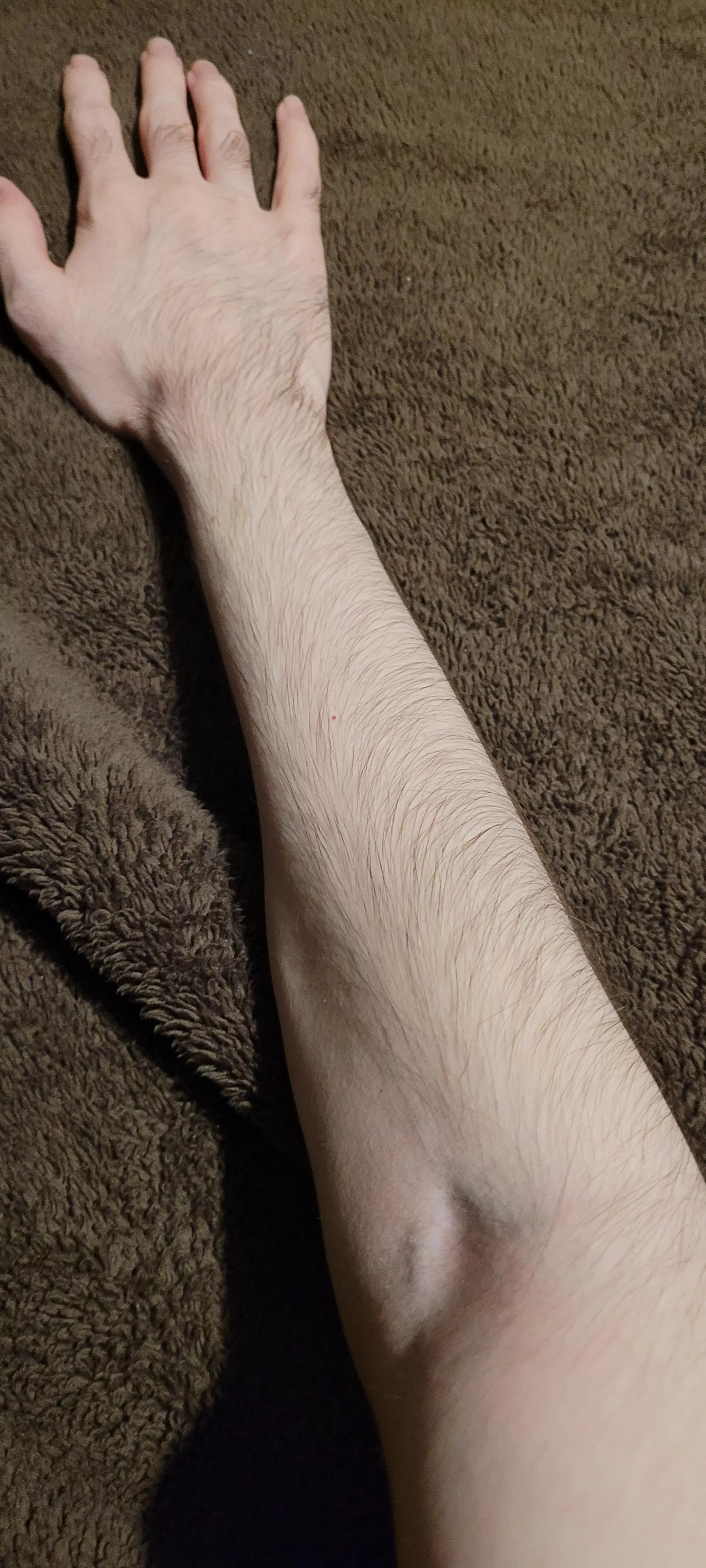 Muscles are optionnal, right ? posted by Slim2u