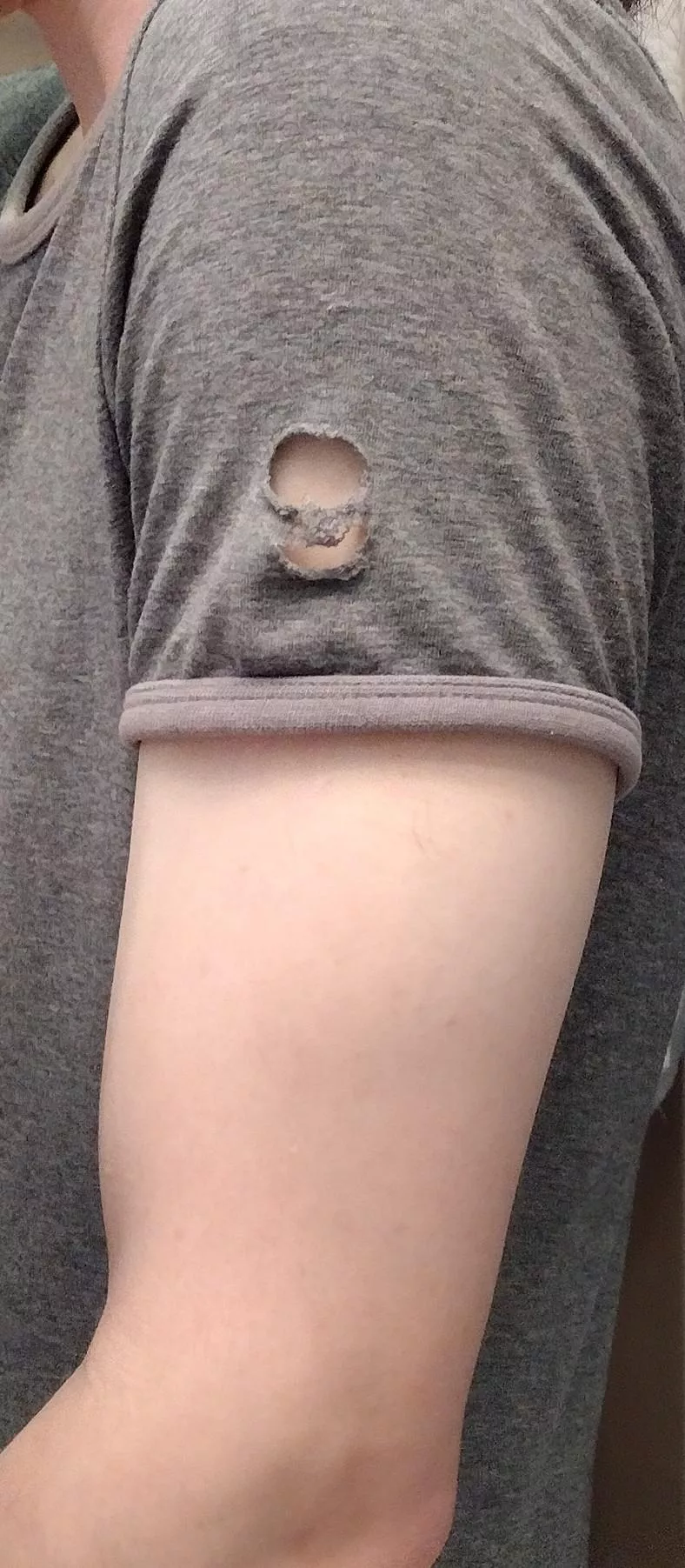 Are there any onesies with. .longer sleeves?? ;-; I keep pulling them down and . . .this keeps happening. . . (ODU) posted by Noble7Light