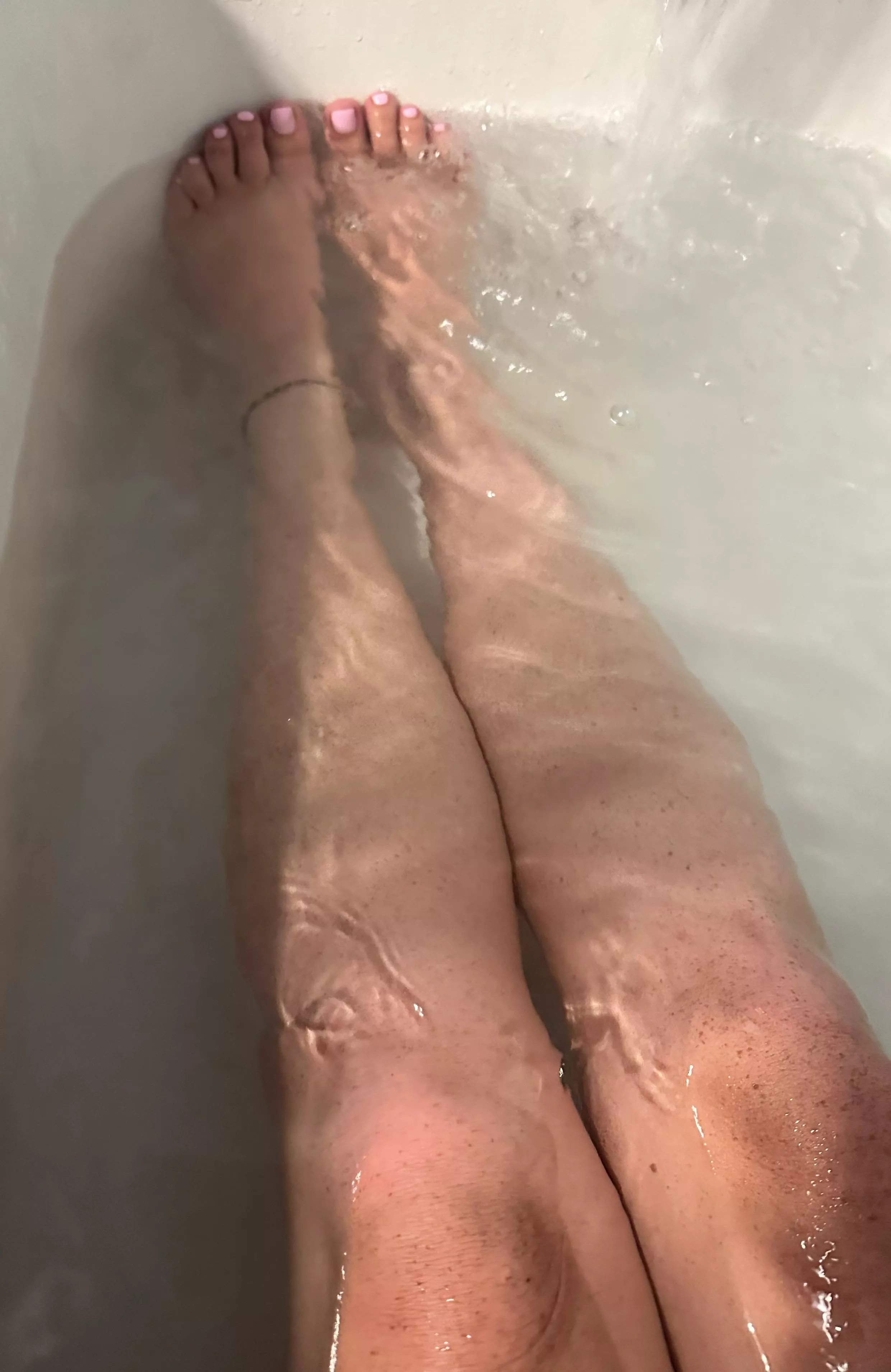 Freckles & toes posted by OutdoorGardener