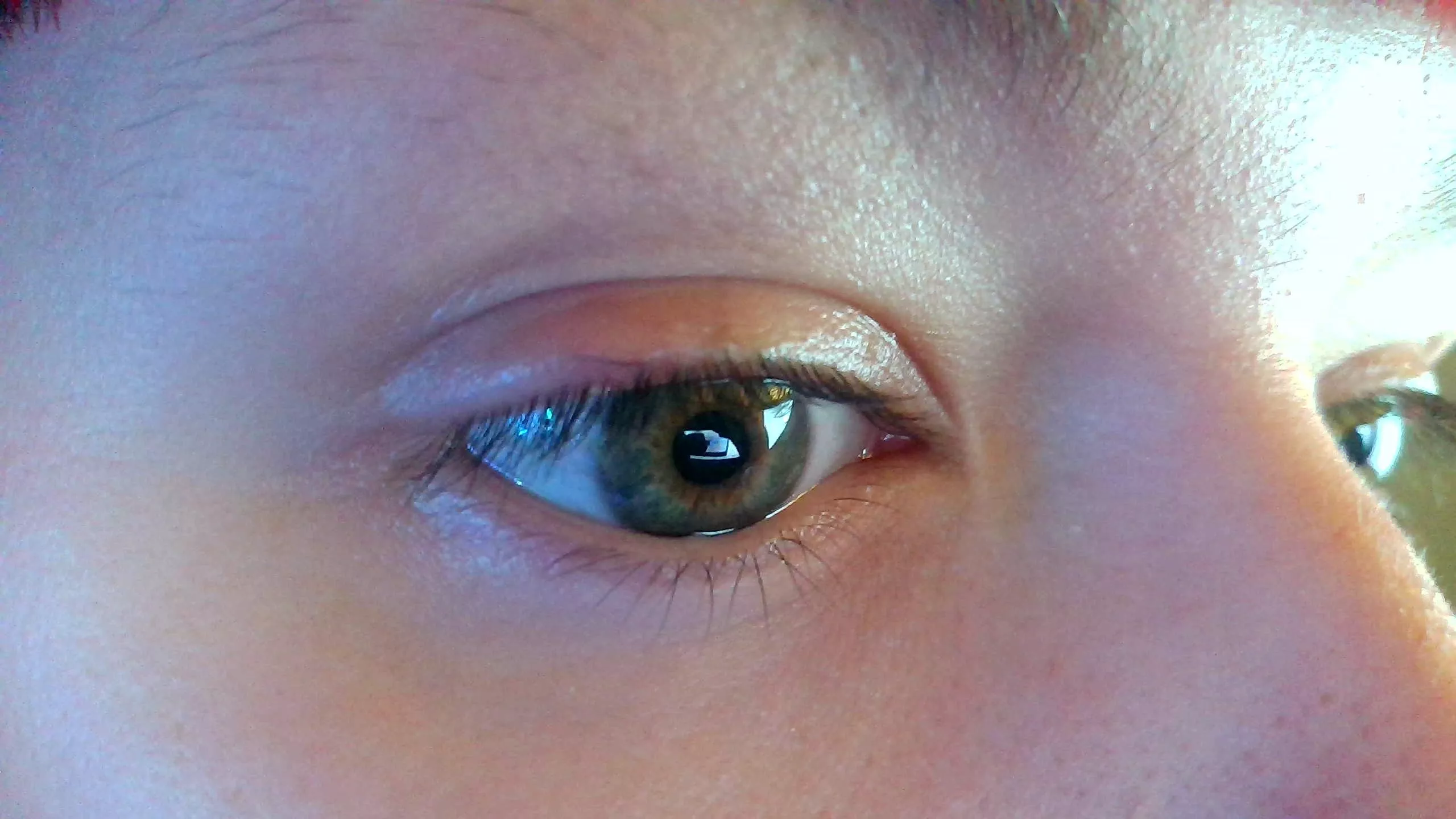 Ingrowing eyelash that is impossible to pluck posted by GenocidalCucumber