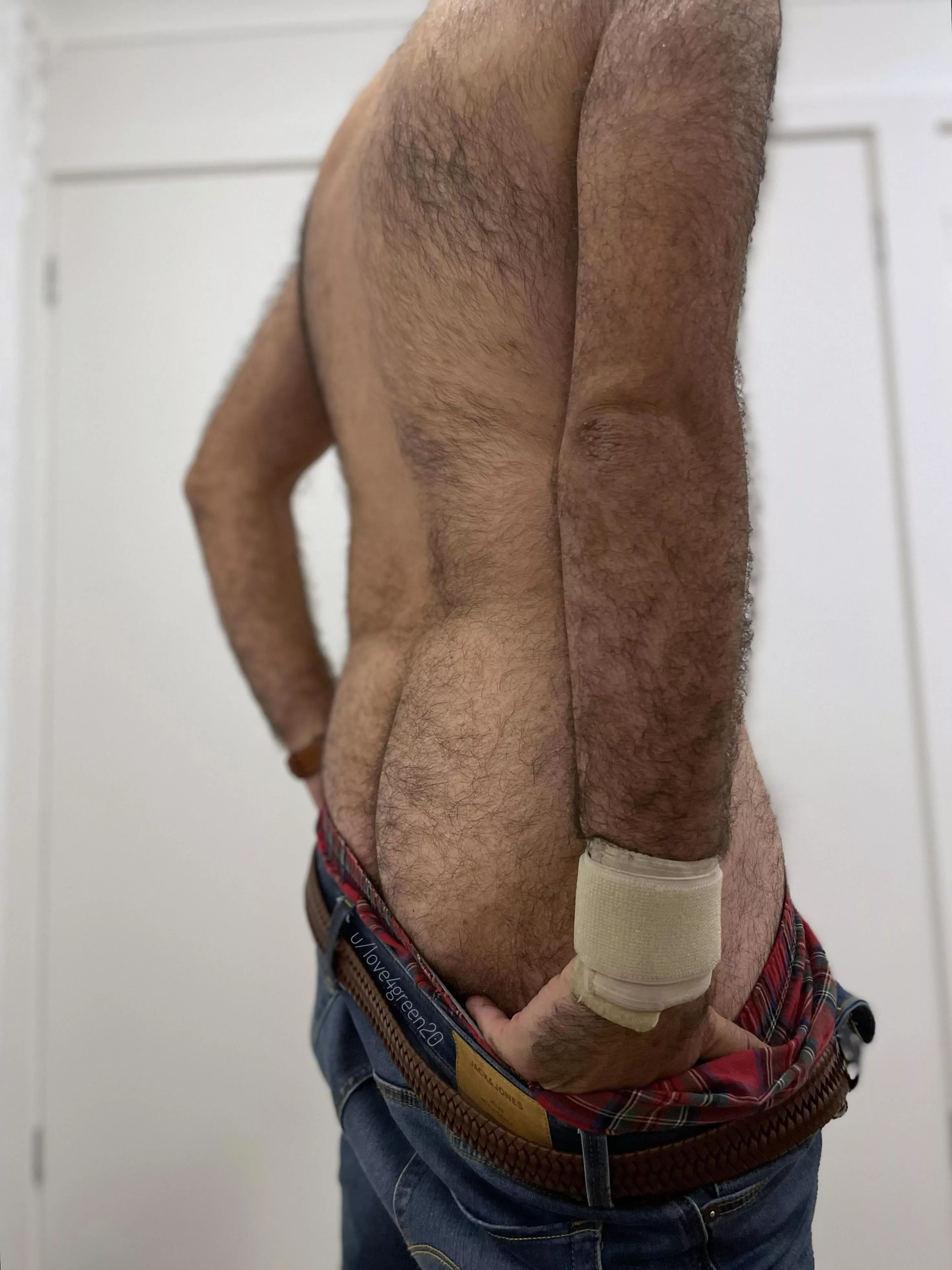 Tis but a butt scratch. posted by love4green20