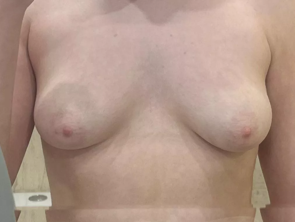 f19, 49kg, 5’1. Are my boobs ugly? posted by bb6608208