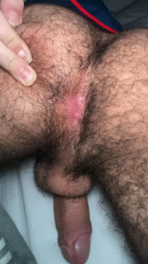 More of my hairy ass by Dry_Classic6932