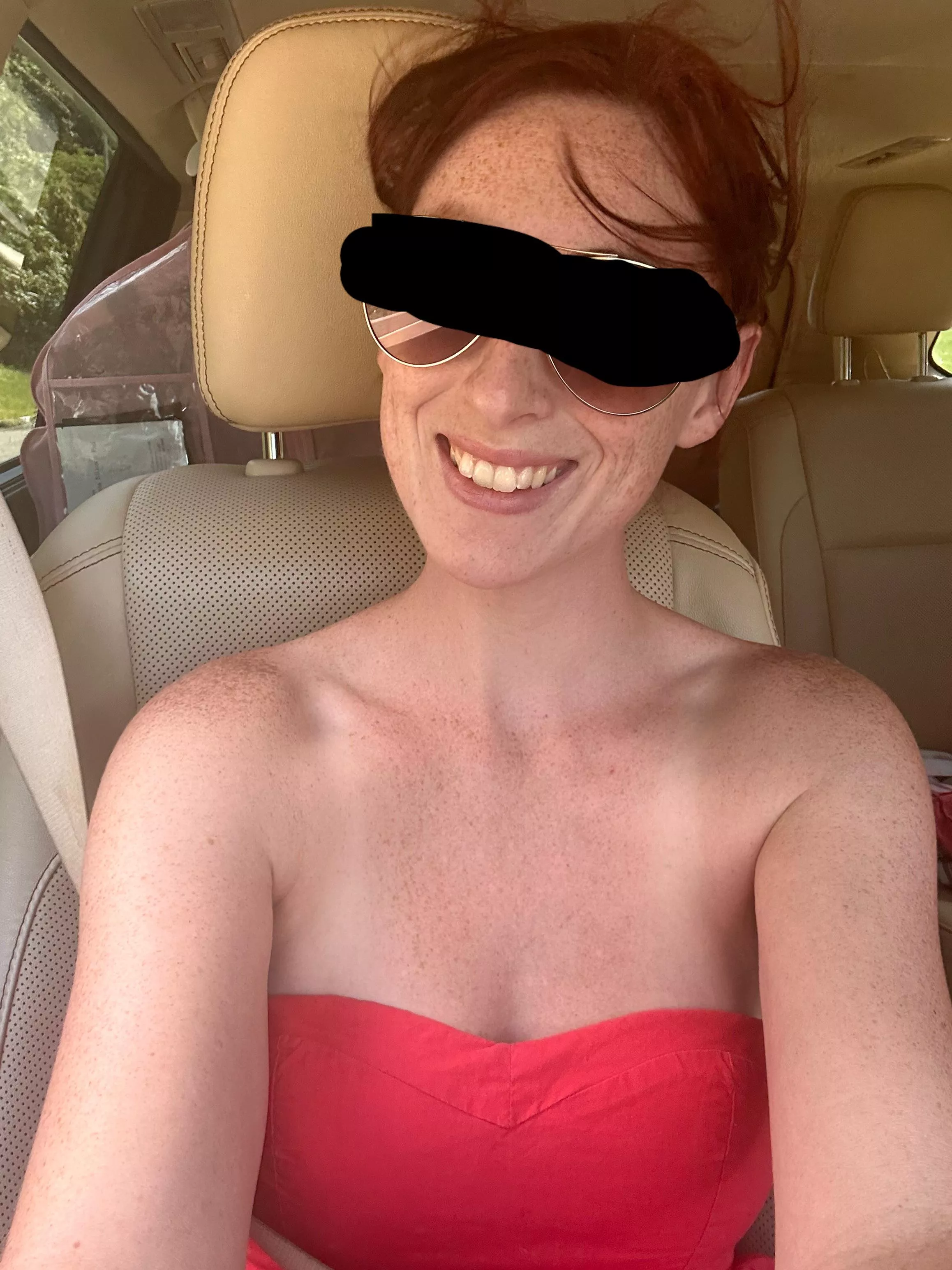 Yea I do have freckles everywhere posted by Cay_Bakes