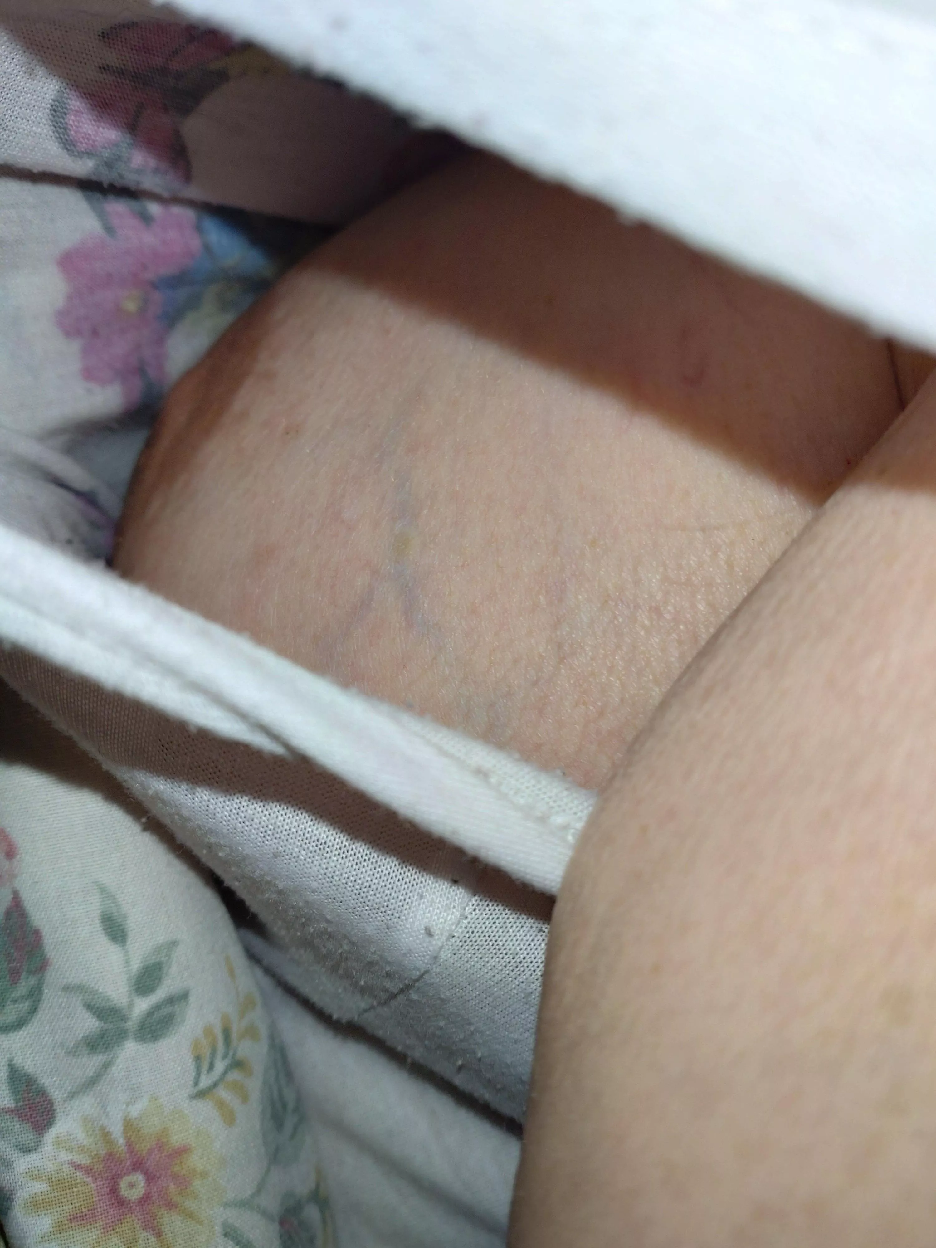 Side boob nipple slip posted by sarasadventures