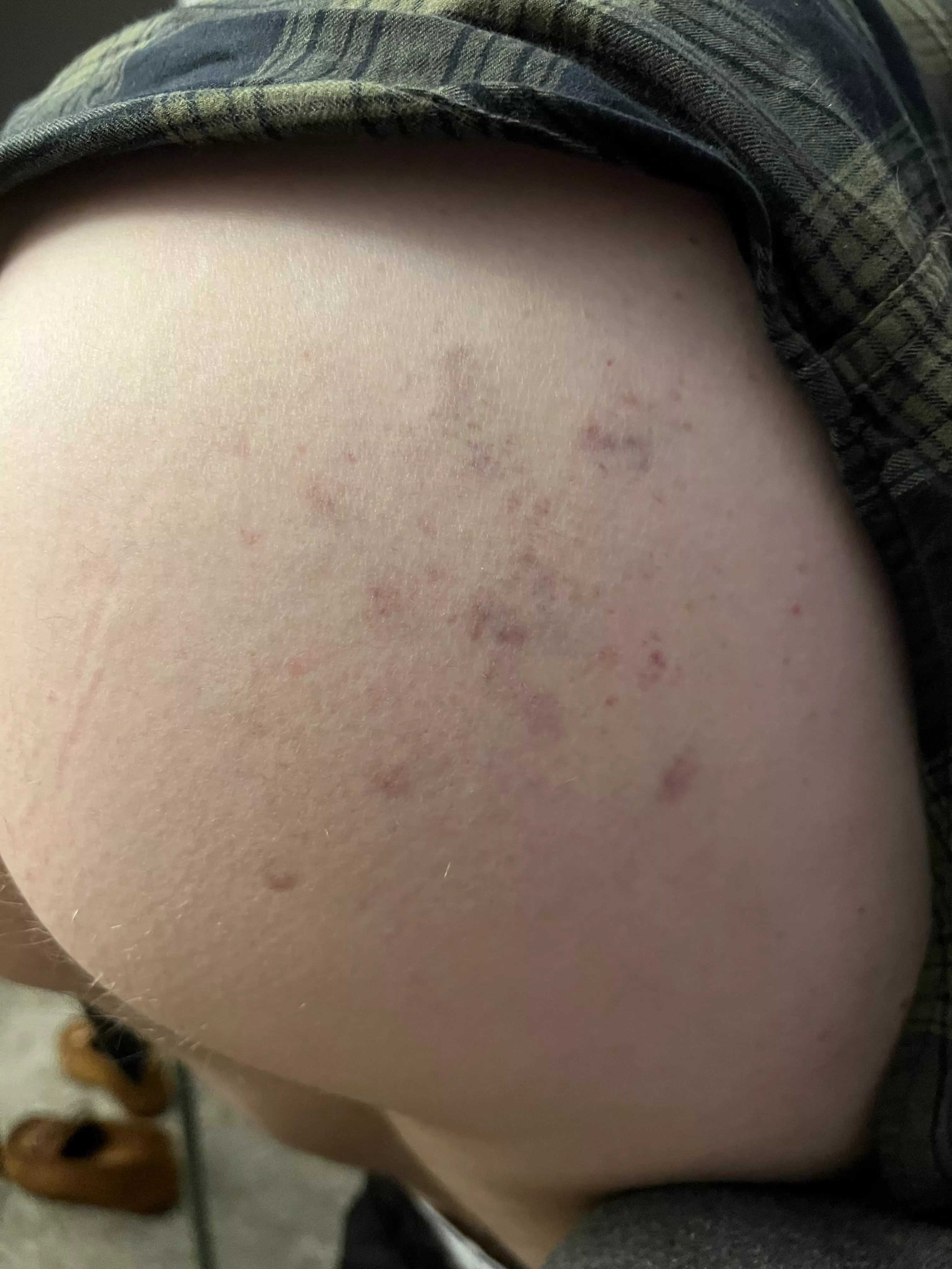 Paddling bruises - they last for days 🤤 posted by moss_merriweather