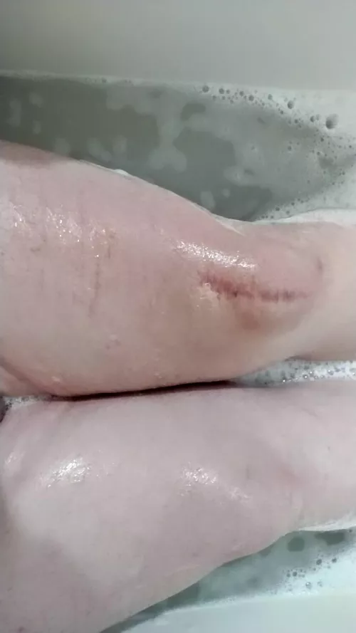 Trans thighs save lives by Lotus-Queen