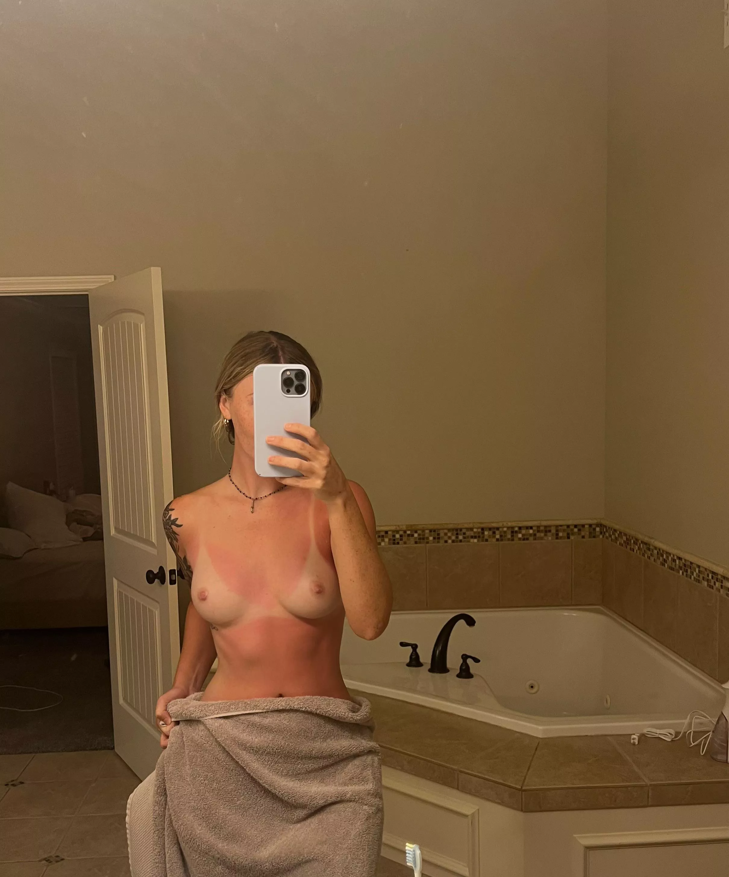 Hoping this burn turns into a tan hehe posted by p3aches_n_cream