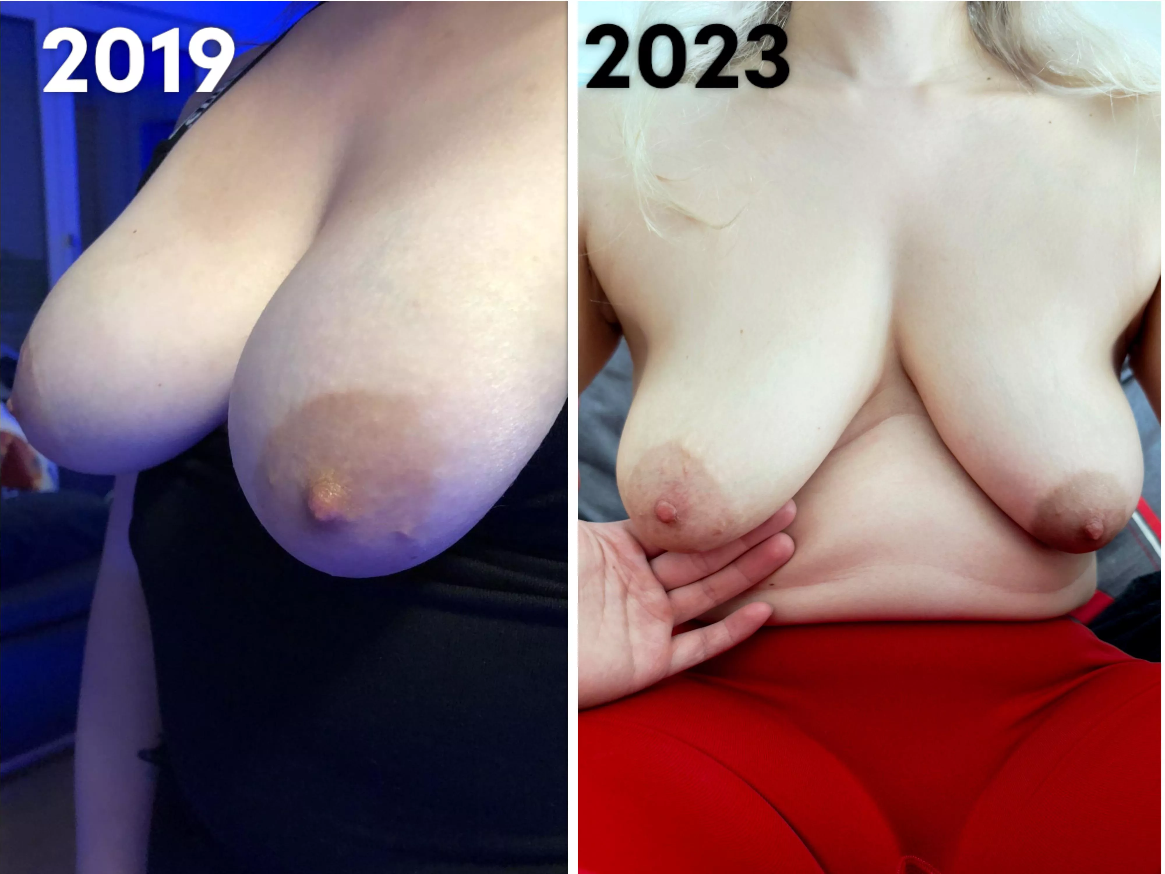 I'm just getting saggy and empty tits like my mom has them (F35) posted by MacL0Vein