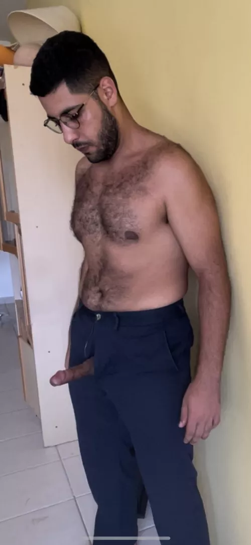 Is it odd that I’m this hairy at age 22? by sunsetlaffite324