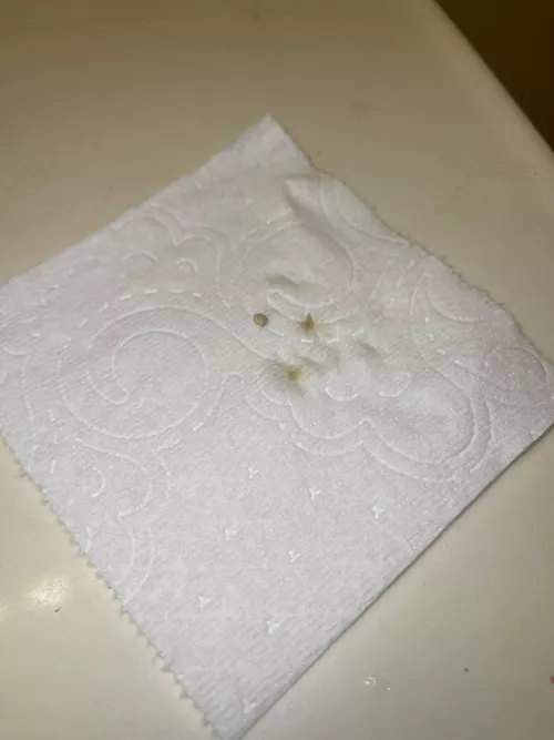 My throat felt weird all day and I had terrible breath when I woke up…wonder why by Total-Cantaloupe3846