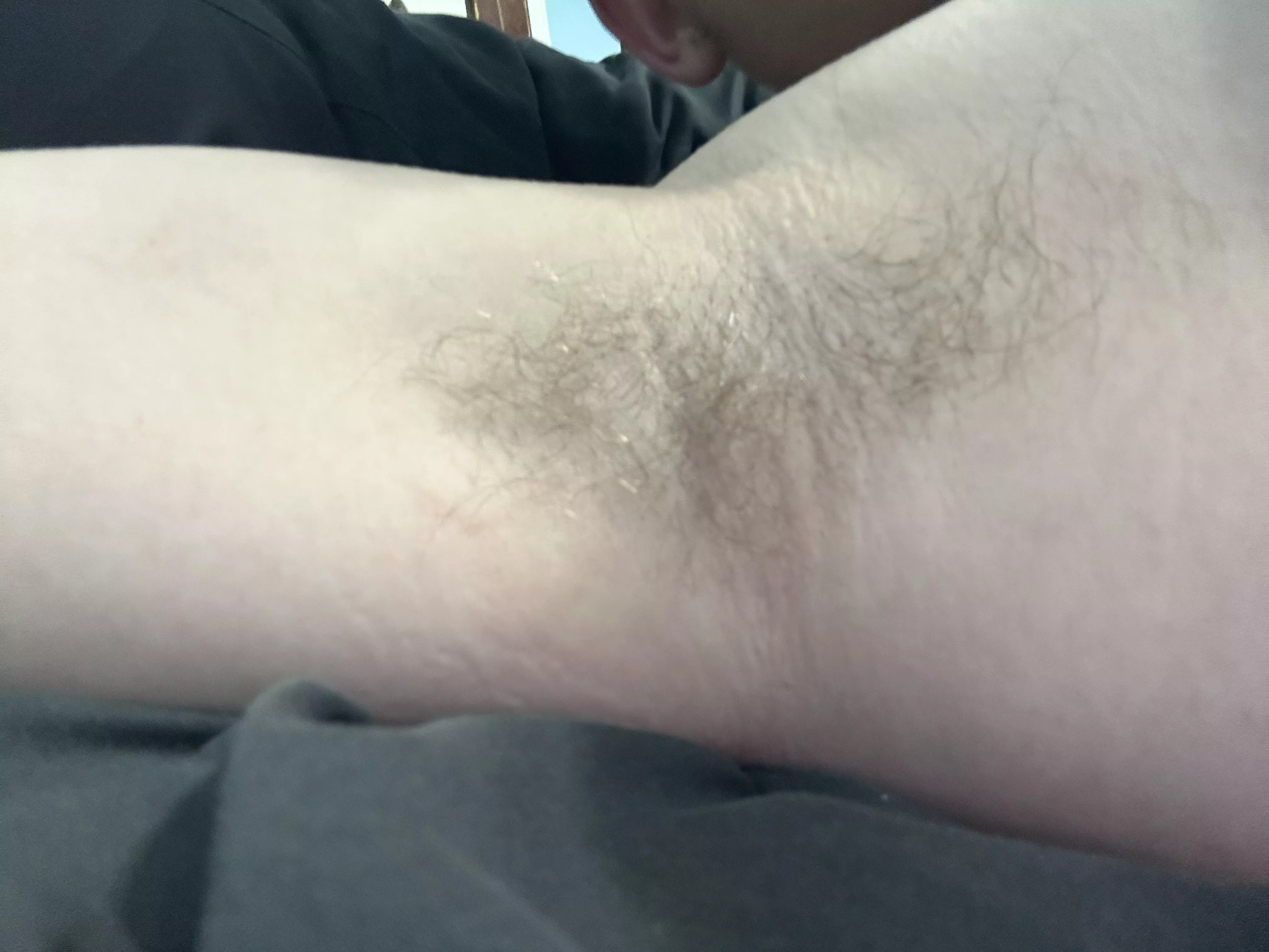 21yo armpit posted by Big-Initiative-8743