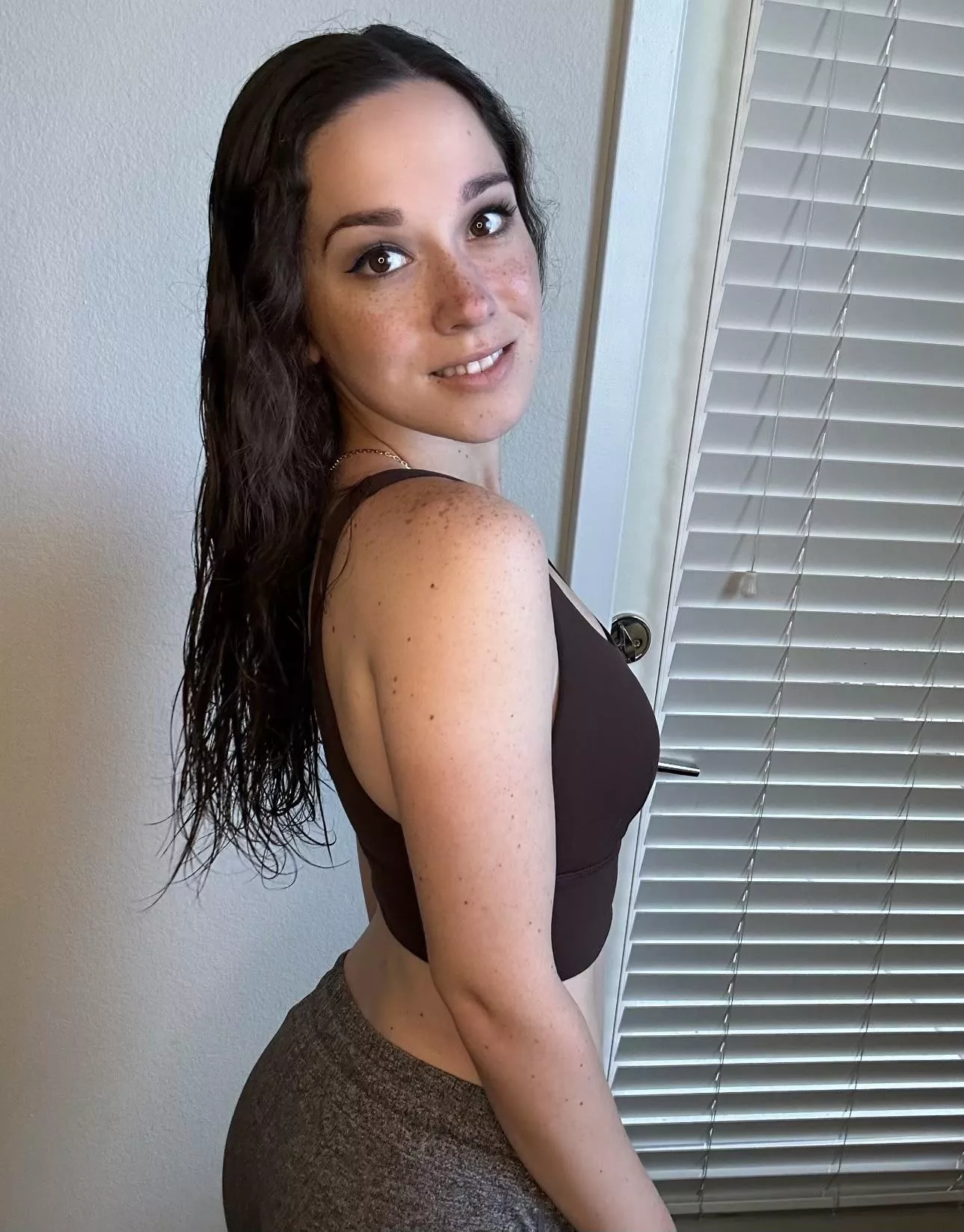 I got a little bit of sun during the weekend and my freckles are popping. posted by AlanaAraya