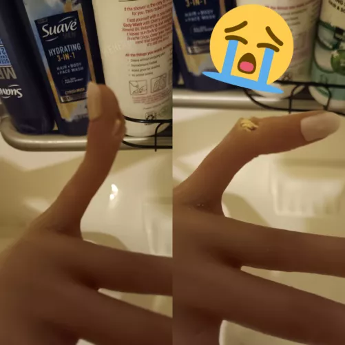 My Game Lady Lara's pinky(s) have become quite fragile! Any tips? by wehere4larac