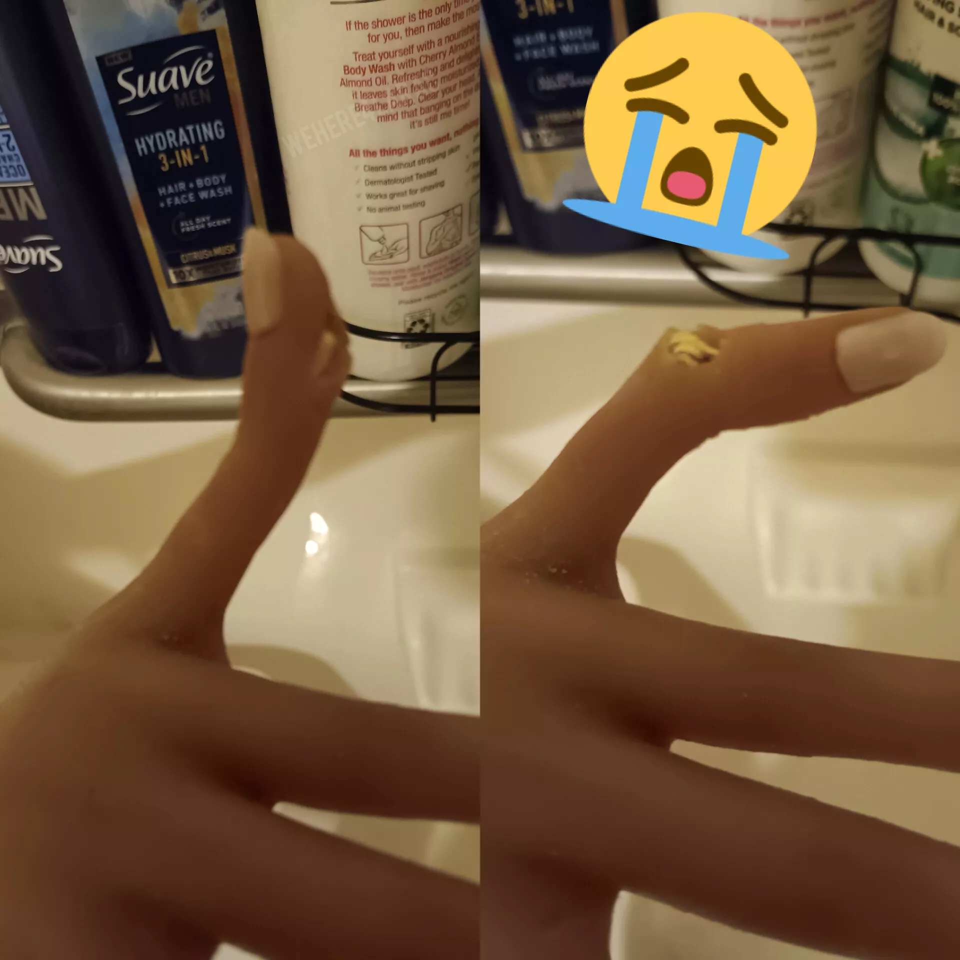 My Game Lady Lara's pinky(s) have become quite fragile! Any tips? posted by wehere4larac