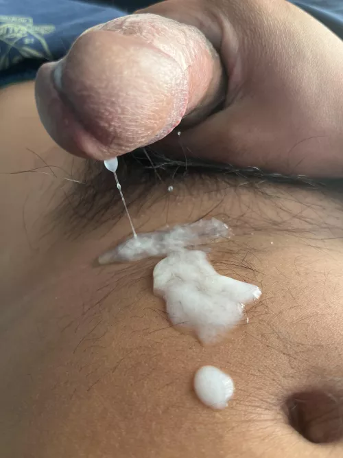 This happened while I was browsing reddit by jamie_6_0_4